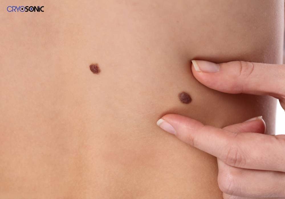 Infection Risk and Poor Aftercare Thame