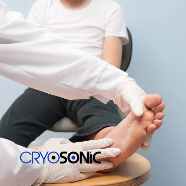 Are you looking for fast effective wart removal Contact us today Thame