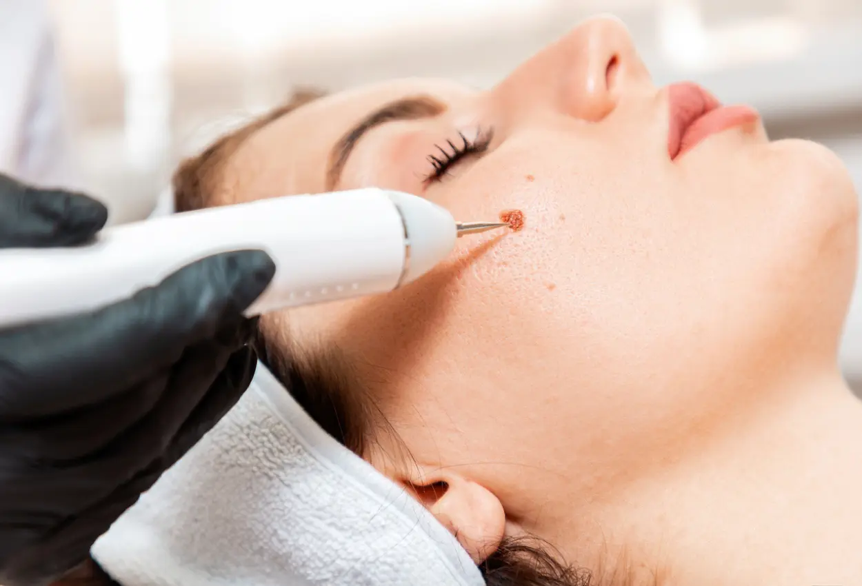 Frequently Asked Questions About Multiple Cryotherapy Treatments Thame